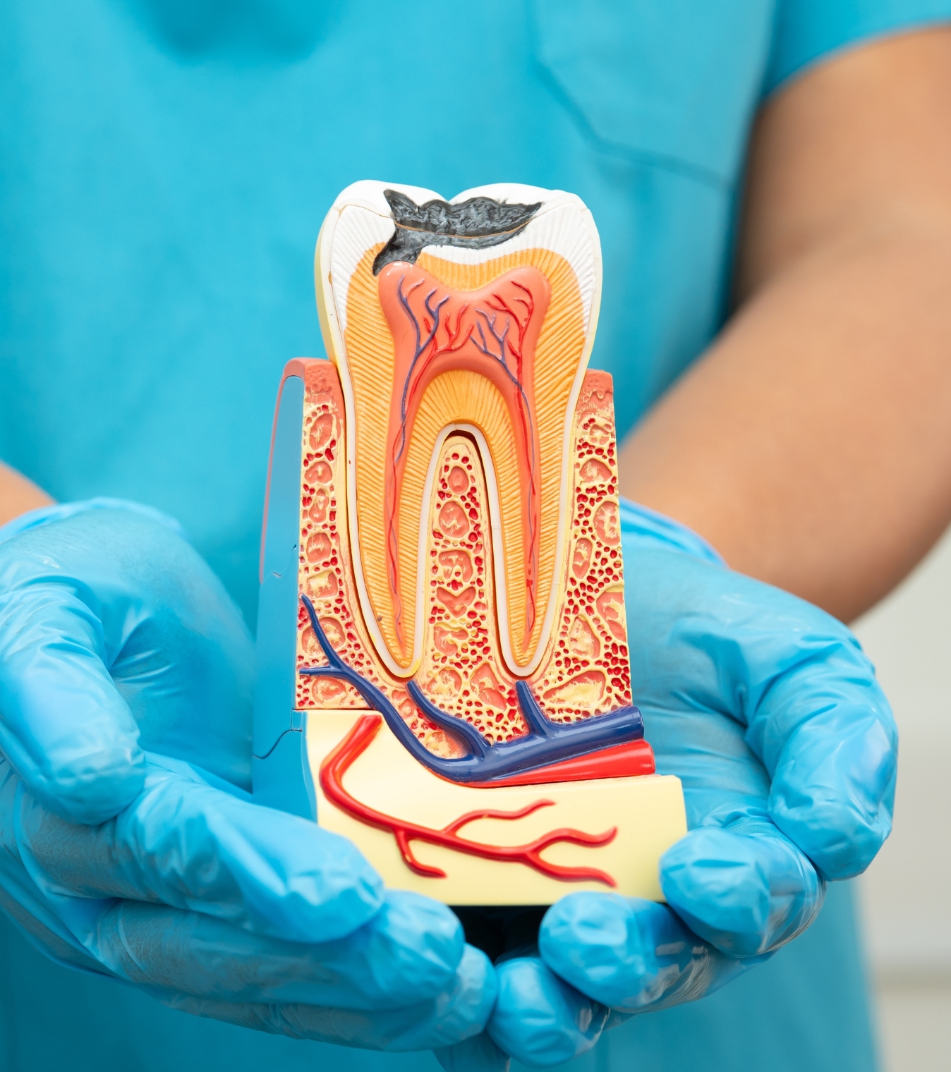 Saving your natural tooth